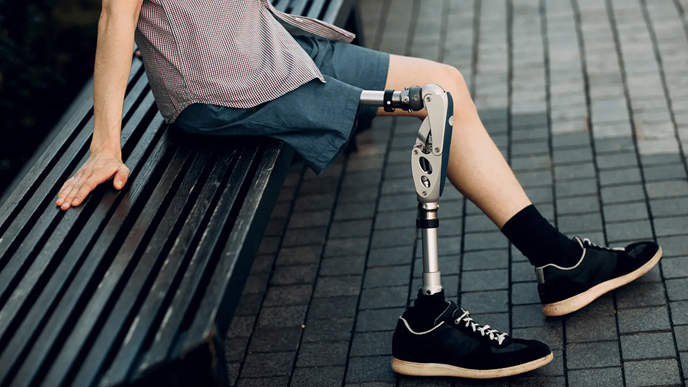 Безоплатне протезування у 2025-му році: понад 56 тисяч українців отримали 208 тисяч засобів реабілітації за державною програмою